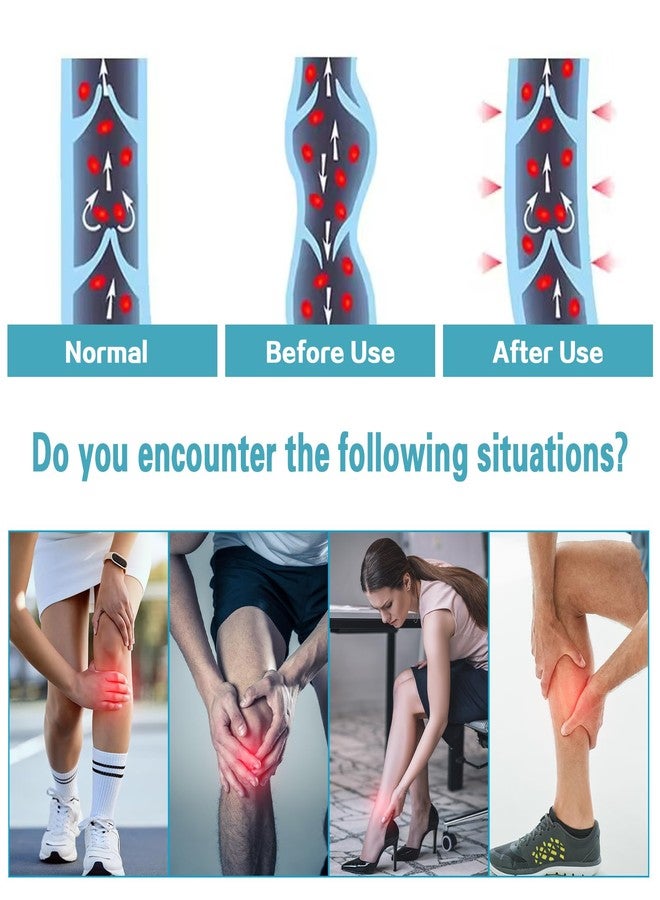جوارب ضغط نسائية من KTINNEAD، ضغط 20-30 مم زئبق، جوارب ضغط طبية مفتوحة الأصابع، جوارب ضغط سميكة تصل إلى الخصر لعلاج الوذمة، والدوالي، والتورم، وللحوامل، والمعلمات، والأطباء - Image 3